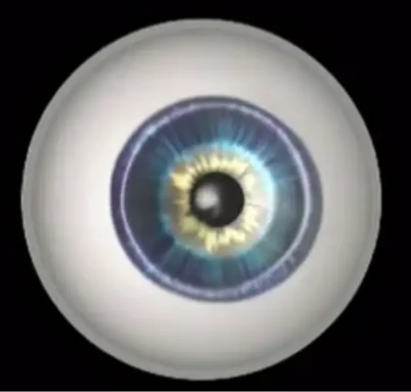 Gujarati - Diabetic Retinopathy