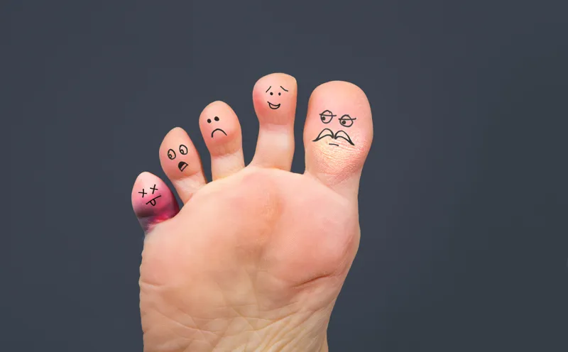 Looking After Your Diabetic Foot Ulcer