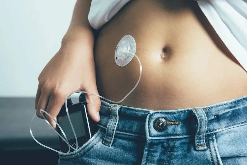 NHS Sick Day Rules for Coronavirus for People on Insulin Pump Therapy